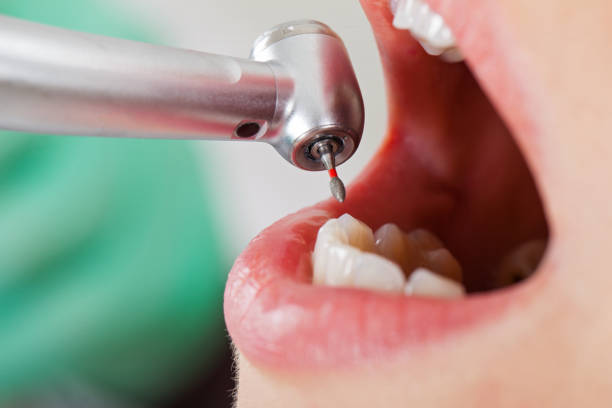 Best Emergency Treatment for Oral Infections in New Haven, MI
